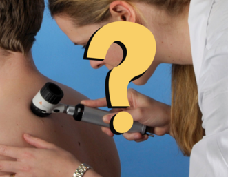 Dermatologin beim Muttermalcheck mittels Auflichtmikroskopieic
